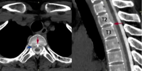 凹进型（新月形）：深思熟虑与固执