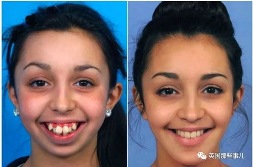 三、 医学矫正及其对面相改善之影响