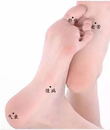 （一） 脚趾缝间有痣：财富积聚的隐秘天赋