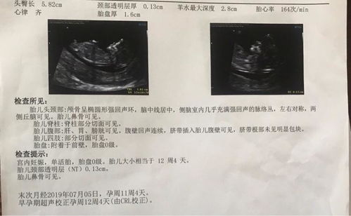 —— 延伸阅读 ——