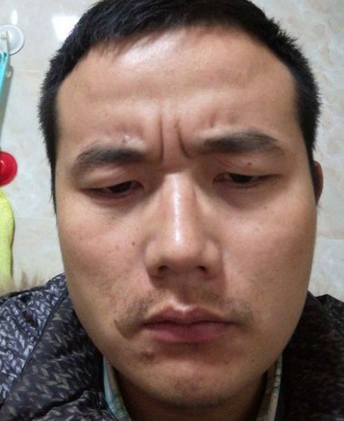 情绪压力与八字纹形成之科学研究关联