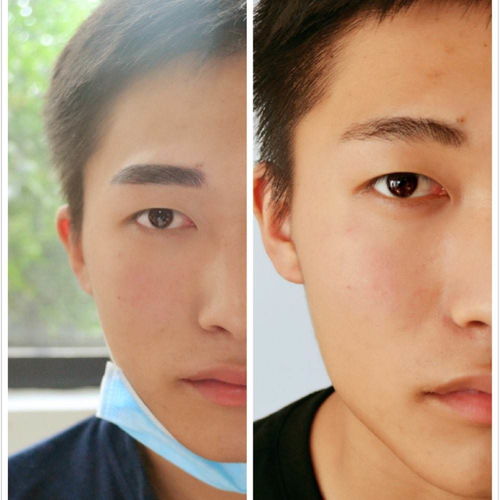 一、蒜头鼻的男人有财运吗