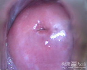 2. 妇科炎症