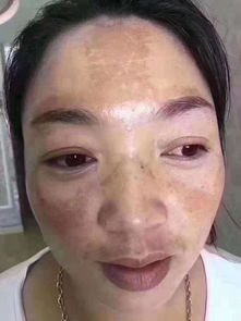 月经不调到底会不会把脸搞成“星球”？