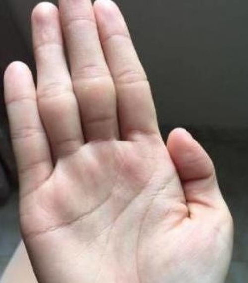 手心金三角和元宝纹，这是否意味着有钱人的手相特征？