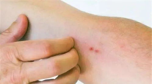 2.2 防护与干预措施