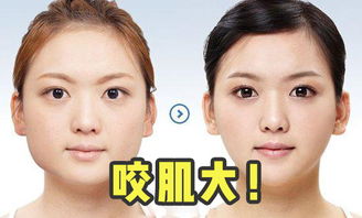 现代医美技术的深度剖析与应用