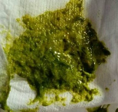 梦见粑粑或大便预示着什么含义？