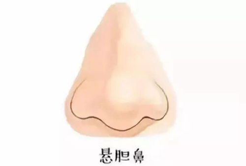 第二大格局：鼻如签筒， 鼻似悬胆