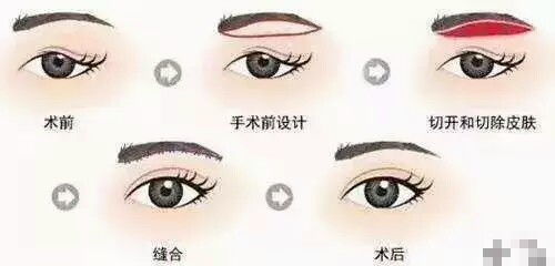 4.1 设计策略差异化处理