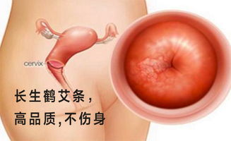 b) 针灸疗法——把穴位当作“较小型电路”调和身体能量流动
