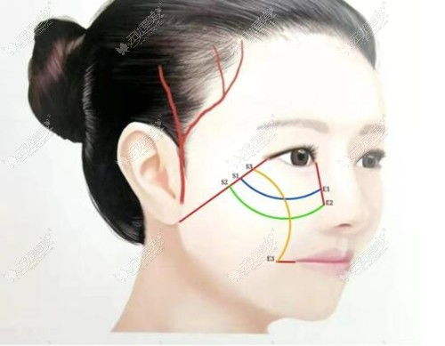 二、 不同形态的双颧及其对应的命运走向