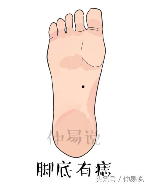 1. 食指较长痣之象征意义