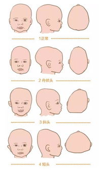 头部区域分析：命运的空间拓扑学