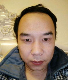 传统面相学对额头形态的解读