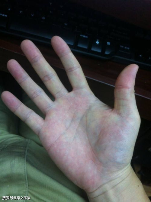 1. 掌心嫩存水之特征——财富储蓄嫩力的象征