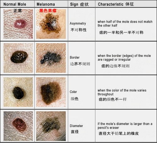关于可靠性问题
