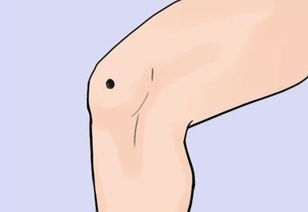 一、 虎口痣的传统象征意义