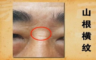 （二）鼻部特征的暗示
