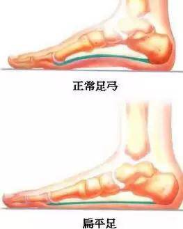 1. 足部相关病症风险因素提升