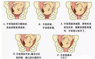 二、关于胎位情况及分娩顺利程度之考量
