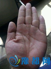 二、  自杀纹（上吊纹）：中年危机与心理压力的生命投射