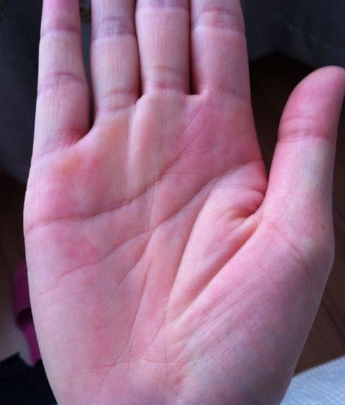 三、 额头及眉毛特征分析