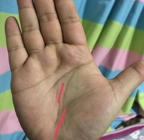 (1) 手掌薄且无肉凸起之结构
