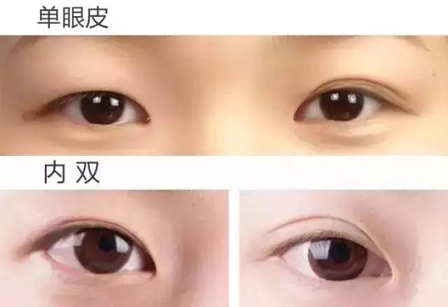 ：眼皮形态与命运关联之学术探讨