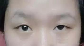 眉毛前浓后淡、 眉周有痣以及口唇痣点的综合解读
