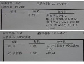 1.1 月经延迟的“时间段表”与名字的“寿命”对照表（随意画的）