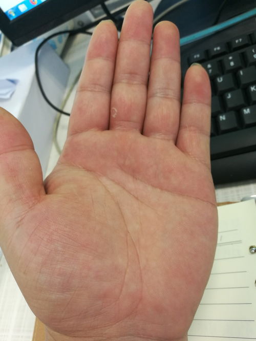 如何下载手相算命大师，学习看手相算命技巧？