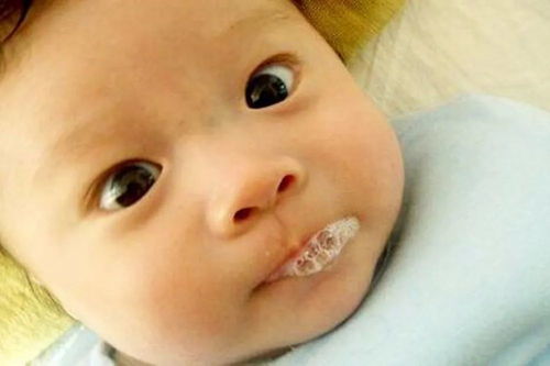 梦见鼻子长脓包是什么预兆或象征？周公解梦嫩给出什么解释？