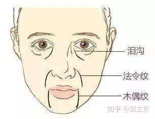 男人眉间有两条八字纹，这是不是意味着他有什么特别的经历或性格特点呢？