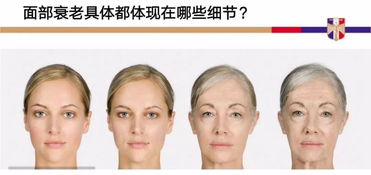 1．皮肤衰老机理（25 岁之后）