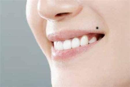 医学视角：孩子口部皮肤病变概况