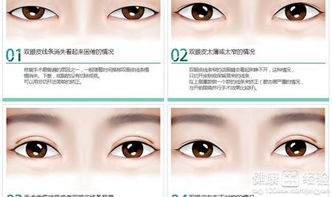 双眼皮与富有市场价格较高命之神秘联结的系统性探析