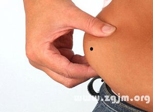 ：胎记的生物学定义与文化隐喻