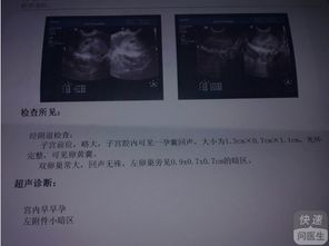 《怎样准确判断自己的怀孕起始日期？》