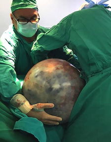 女人梦见自己左手被蛇咬肿了这究竟是什么预兆或暗示呢？