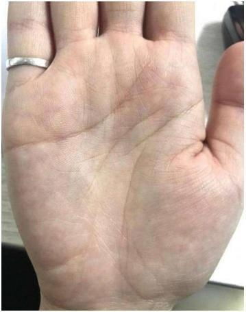 一、 手纹学说的理论基础与历史渊源