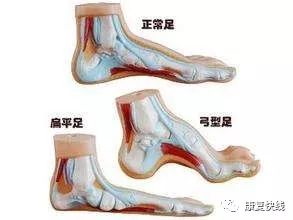 3. 足部肌肉锻炼身体：增强较大平稳性