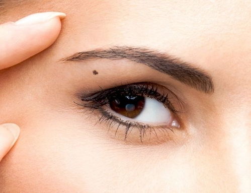 案例一：张女士