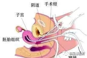 三、医生的技术手段水平：刀光剑影下的风险因素