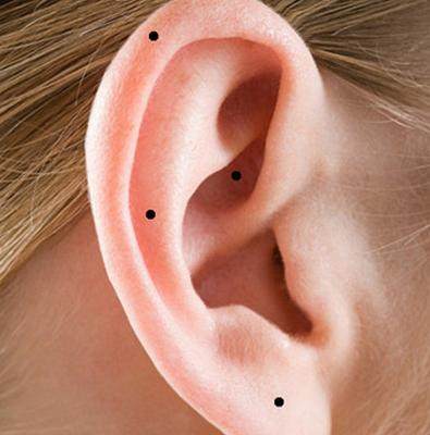 2. 耳珠（耳垂）有痣——财运旺盛与家庭福祉