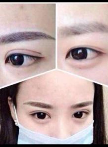 四、 美容纹绣领域中的操作要点与技术建议