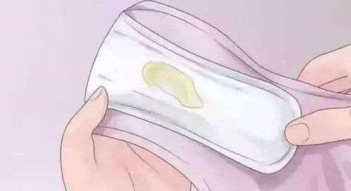 5. 阴道分泌物异常：不止是出血