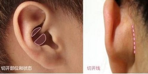 b) 较小丽案例——从心理状态压力到自信蜕变