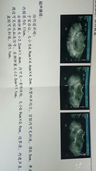 二、 概念辨析：“婴灵讨债”与“受生阴债”的本质区别