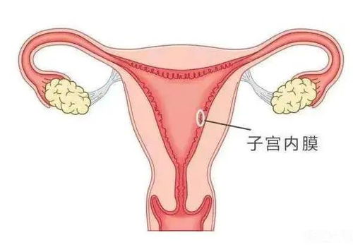 子宫内膜损伤与激素反馈